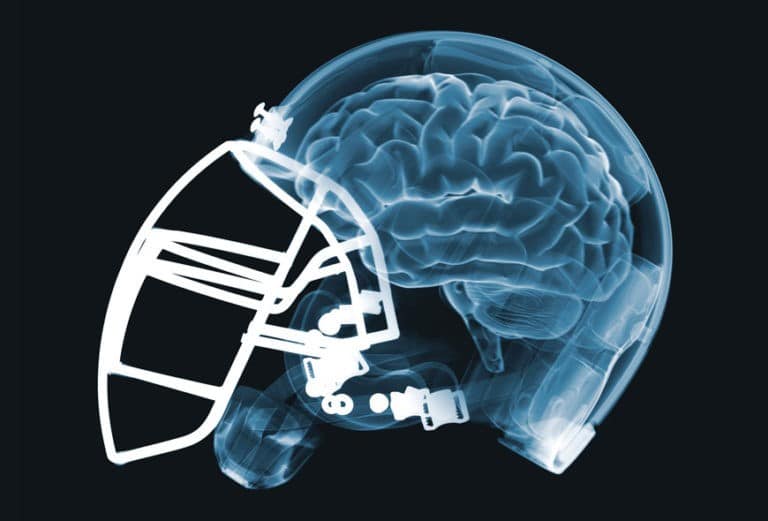 The Reality Of Football Head Injuries