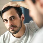 Millennial Magazine- hair loss