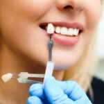 Millennial Magazine- dental implants