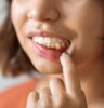 Millennial Magazine - gingivitis