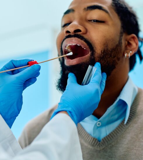 Millennial Magazine - Health - Strep Tests